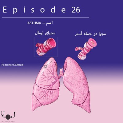 اپیزود بیست و ششم: آسم
