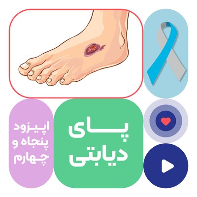 اپیزود پنجاه و چهارم: پای دیابتی